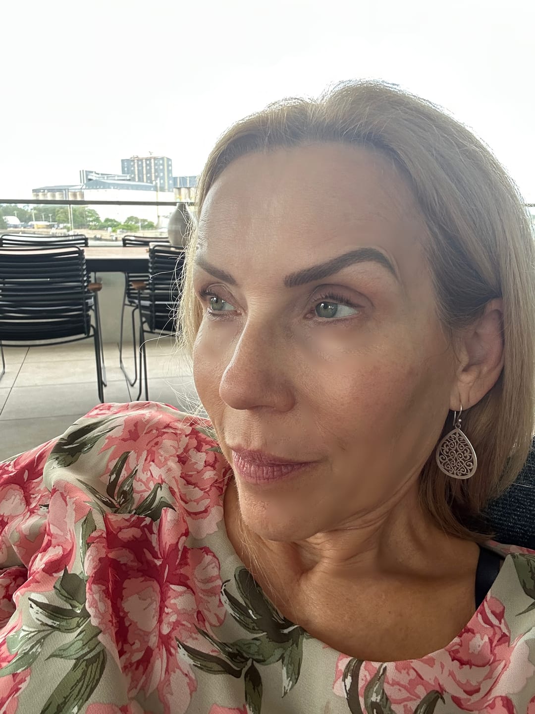Customer photo review of Forever Bright Skin Set