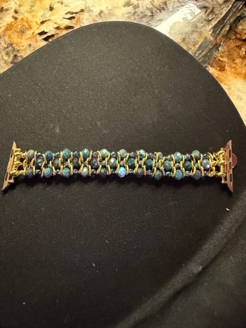 Customer photo review of Crystal Shores Braided Apple Watch Strap