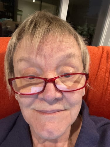 Customer photo review of Spare Battery Pair (7V) Keep a Backup Set