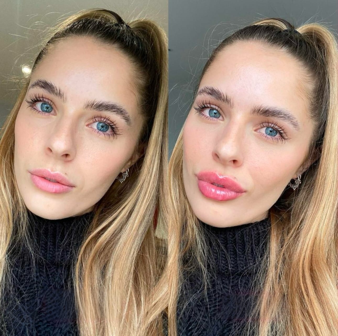 Customer photo review of Premium Lippen-Booster