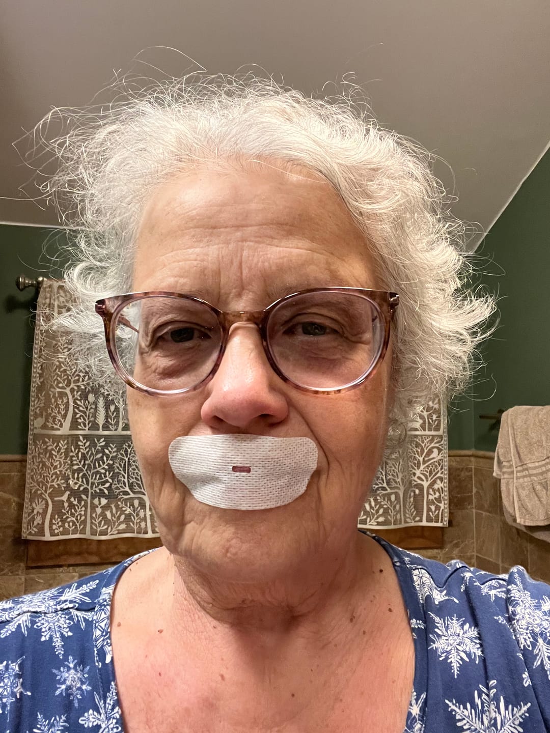 Customer photo review of oi tape™ vented mouth tape