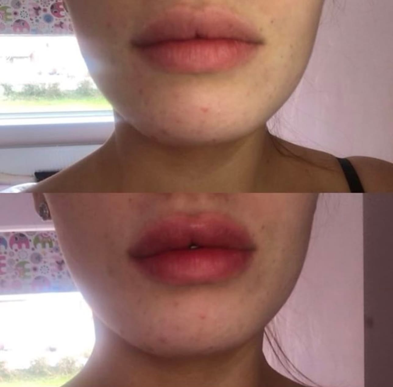 Customer photo review of Premium Lippen-Booster