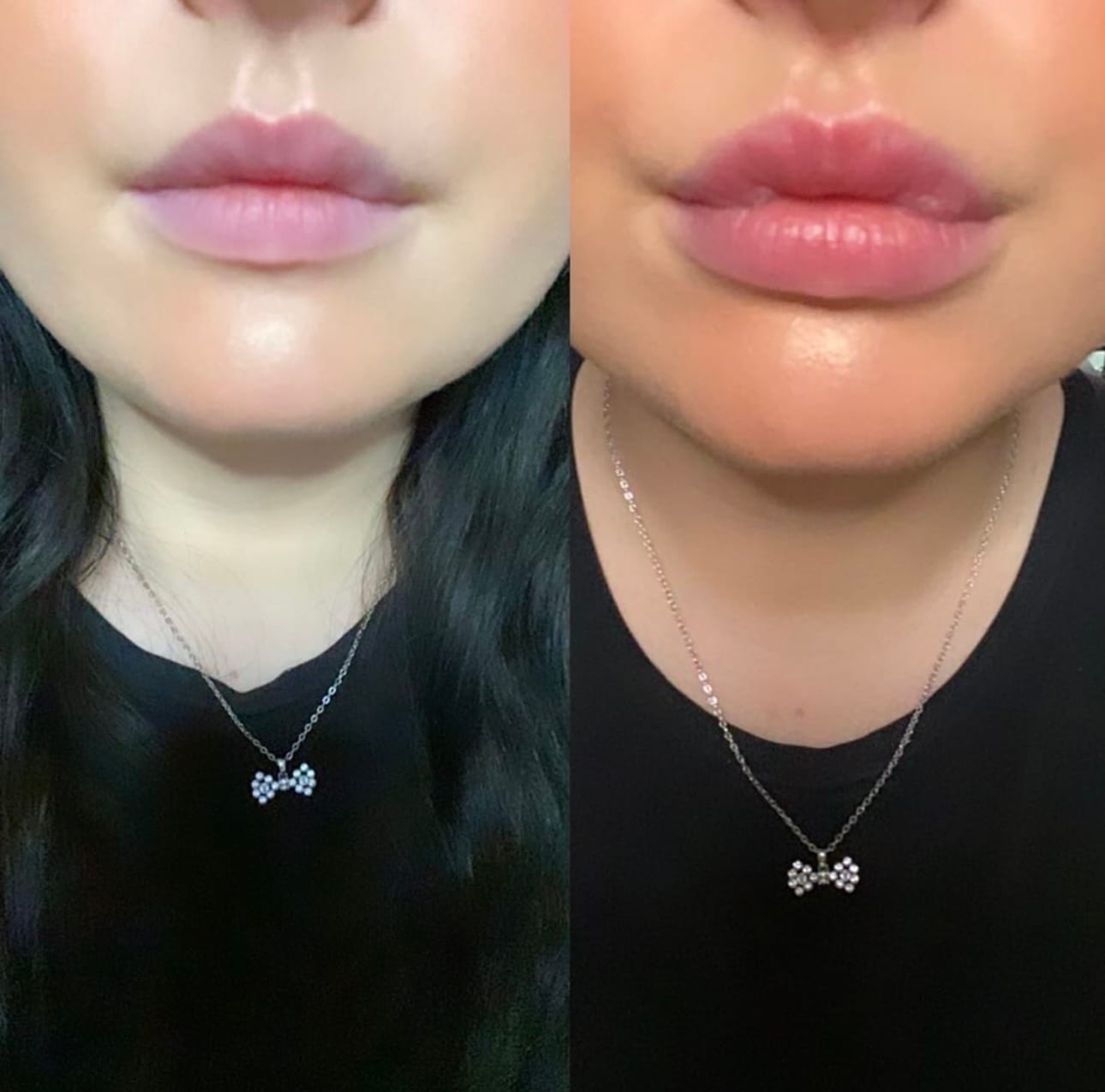 Customer photo review of Premium Lippen-Booster