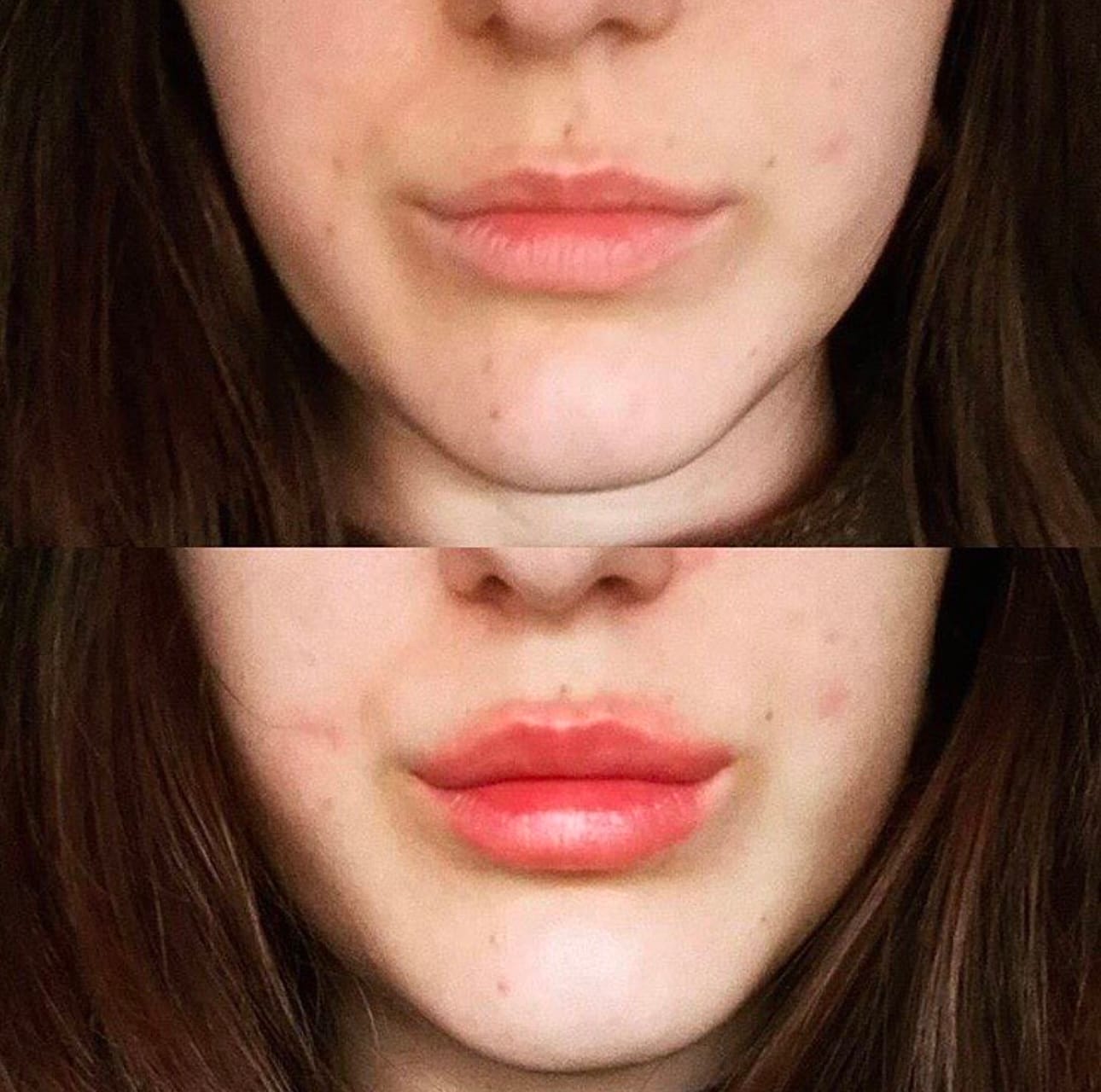 Customer photo review of Premium Lippen-Booster