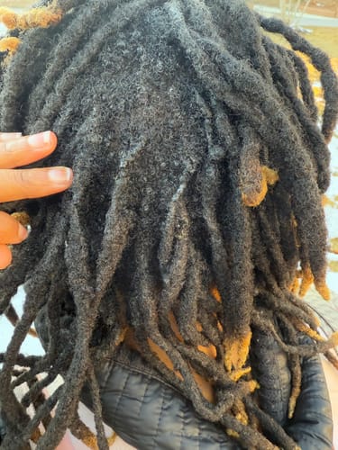 Customer photo review of JUMBO Scalp Stimulator