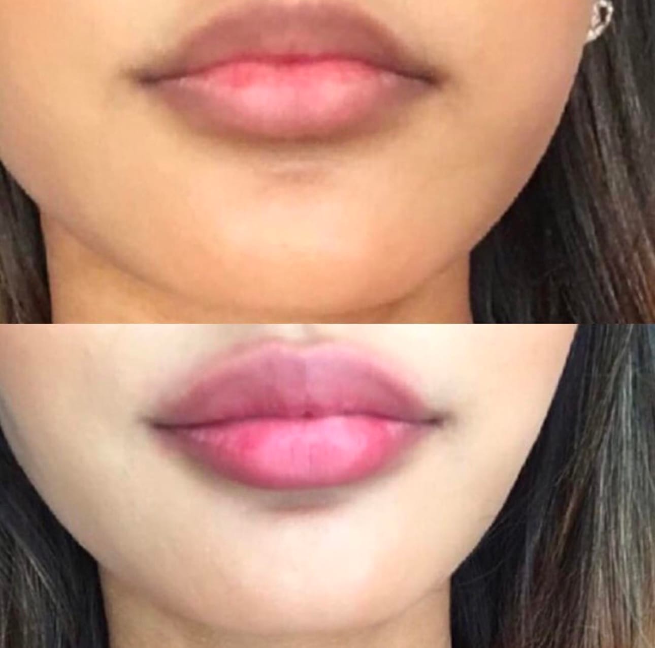Customer photo review of Premium Lippen-Booster