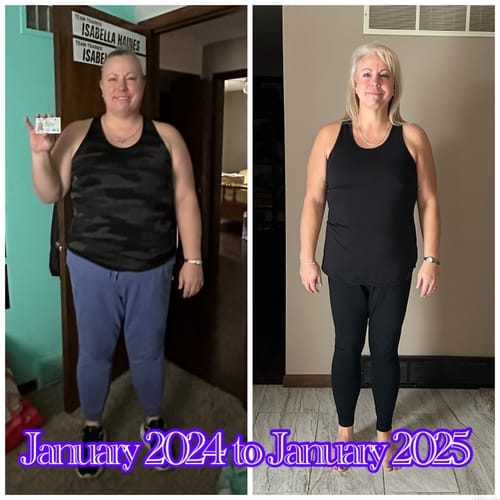 Customer photo review of Tirzepatide Weight Loss Program