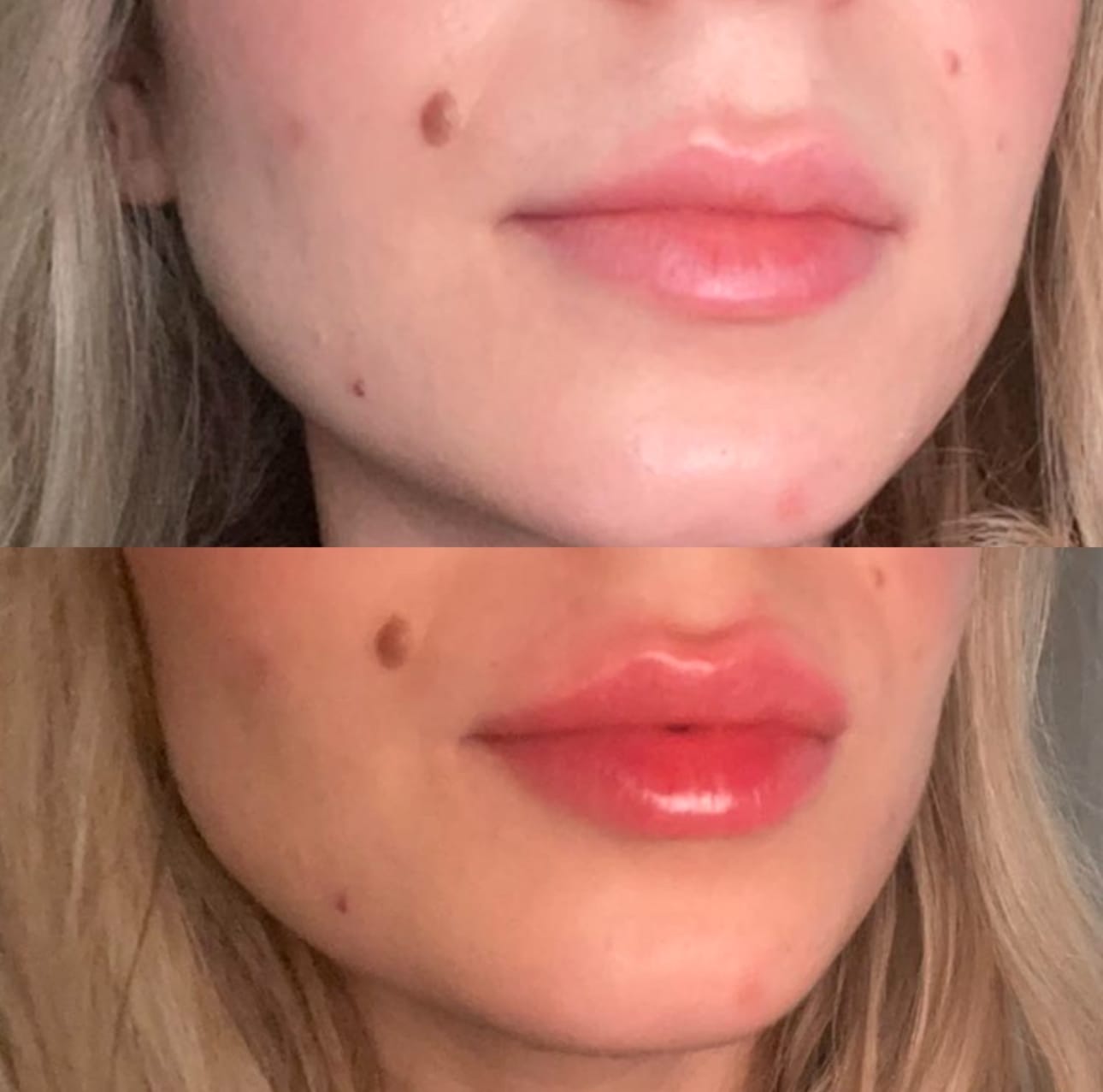 Customer photo review of Premium Lippen-Booster