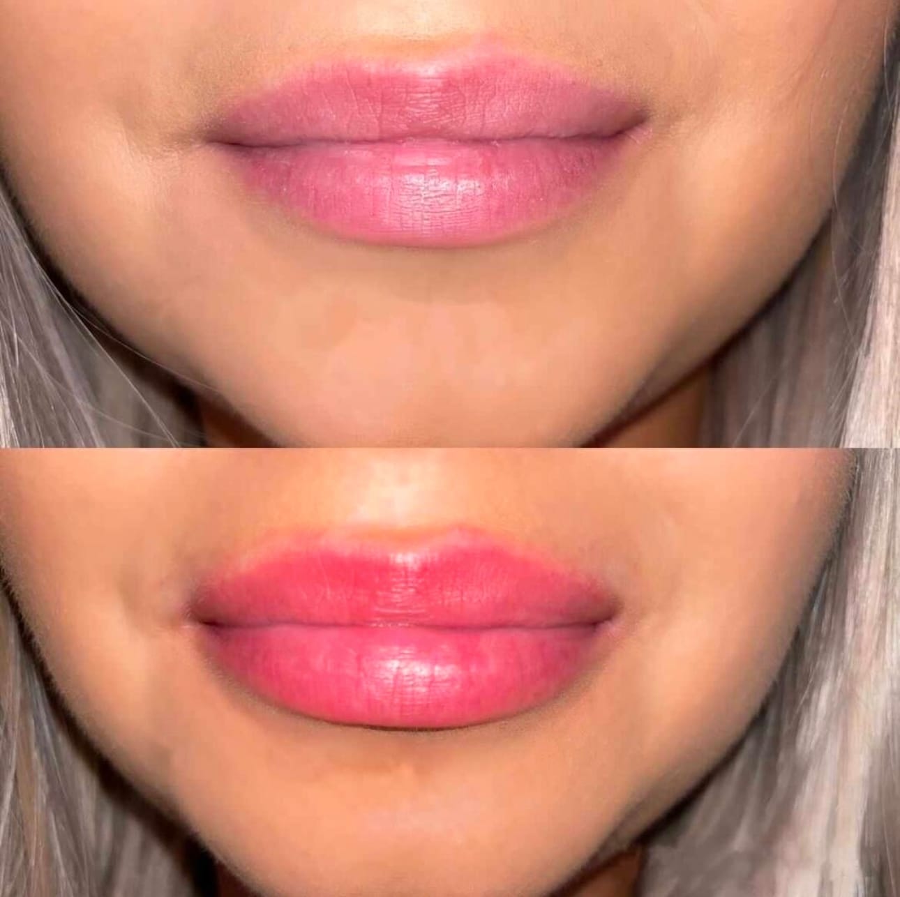 Customer photo review of Premium Lippen-Booster