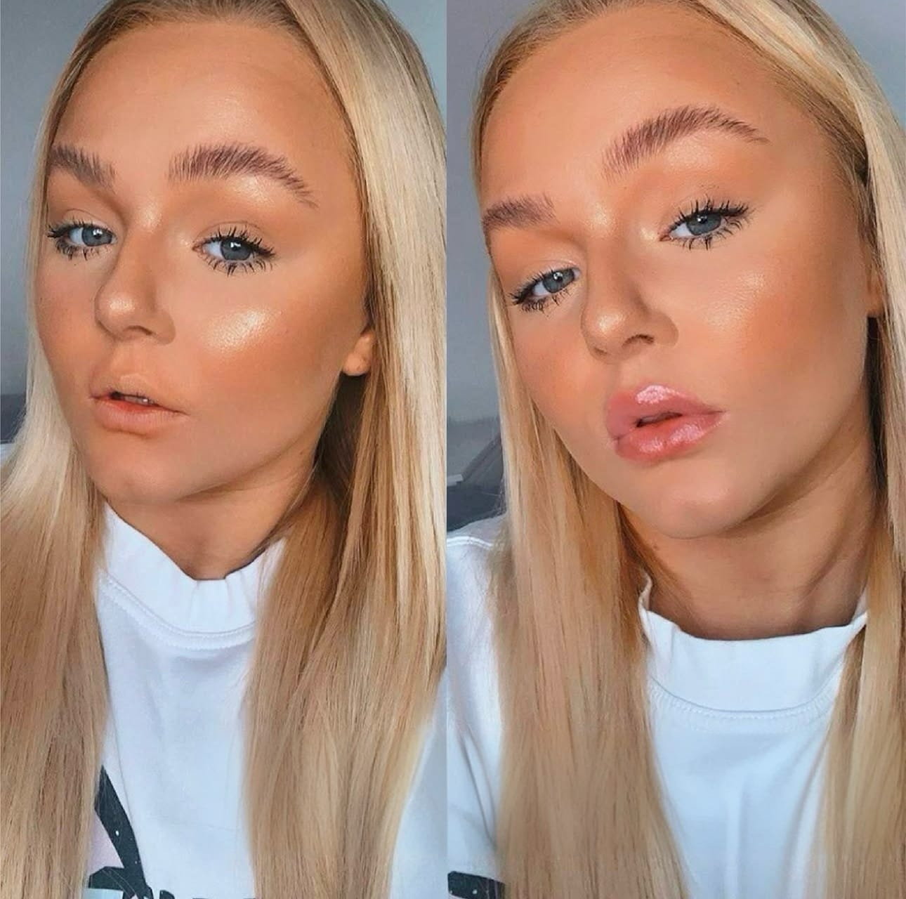 Customer photo review of Premium Lippen-Booster