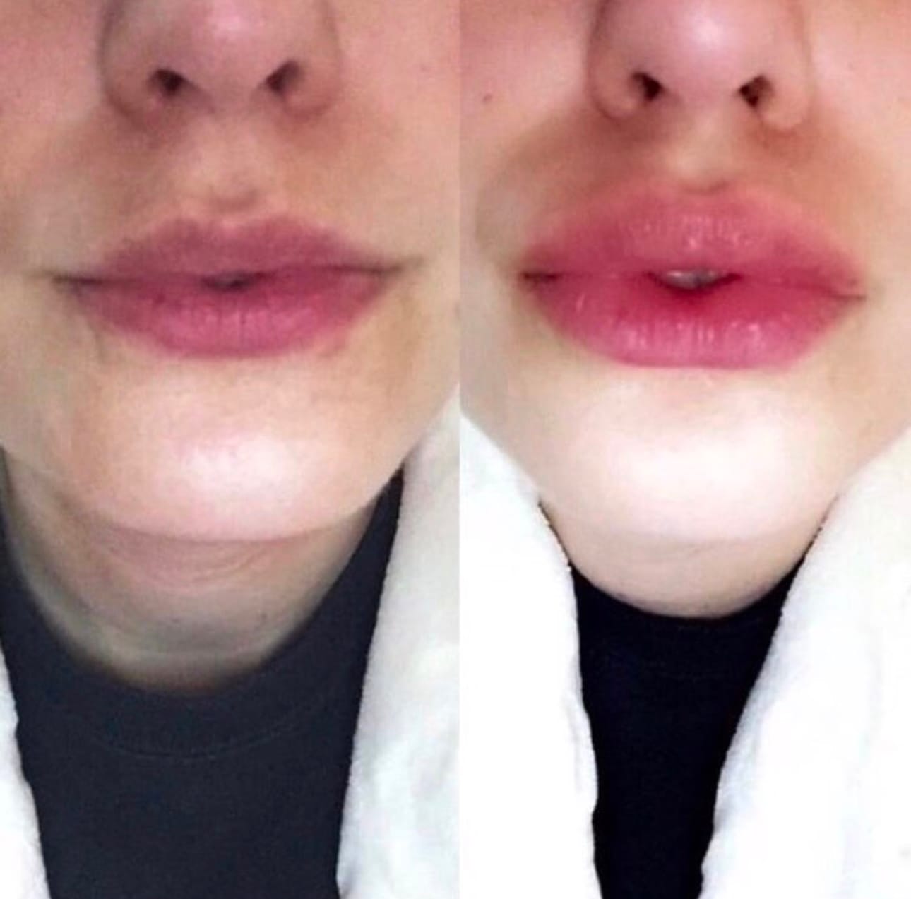 Customer photo review of Premium Lippen-Booster