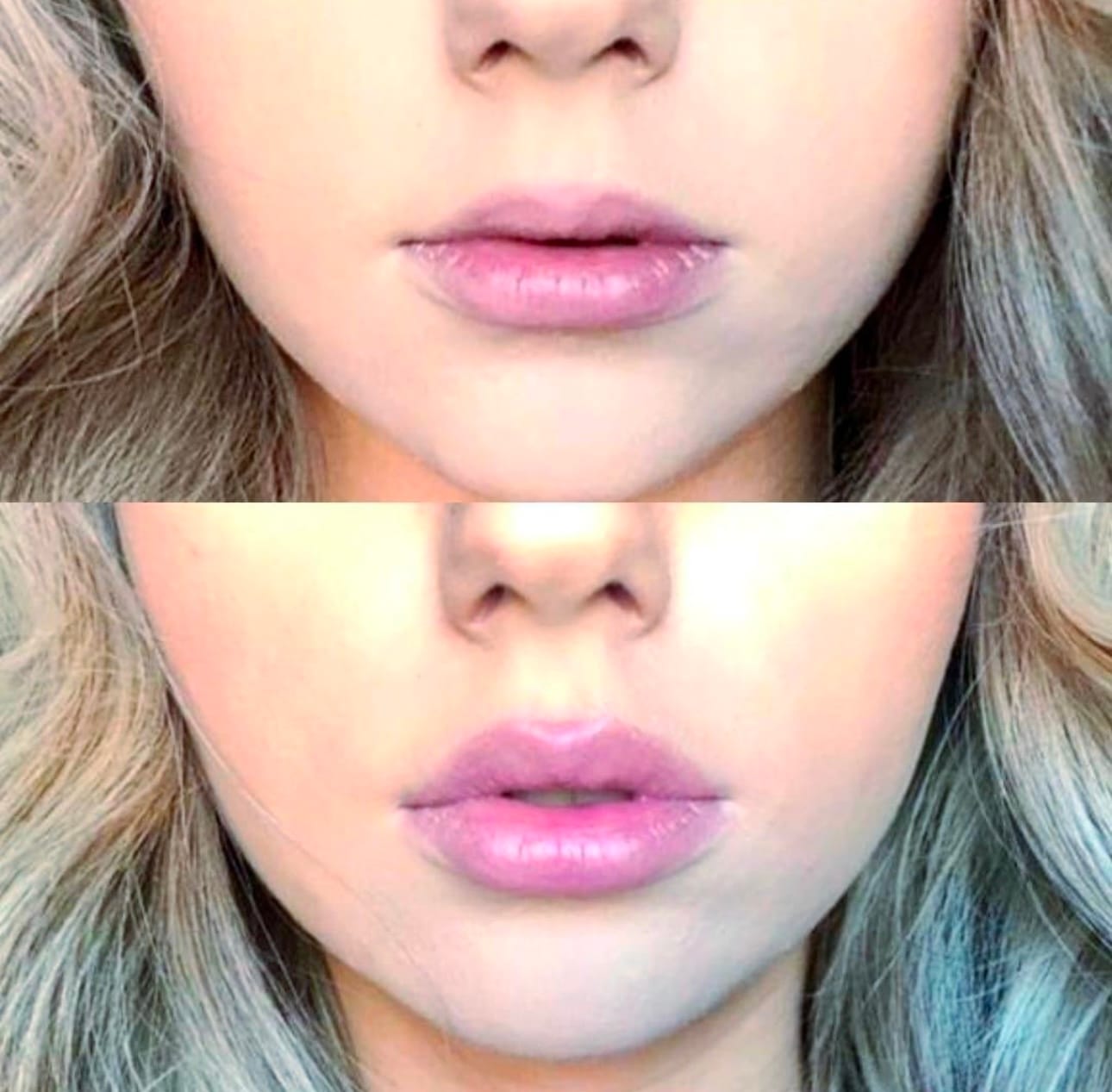 Customer photo review of Premium Lippen-Booster