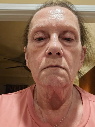 Customer photo review of LiftLab Sculptor + Free Serum