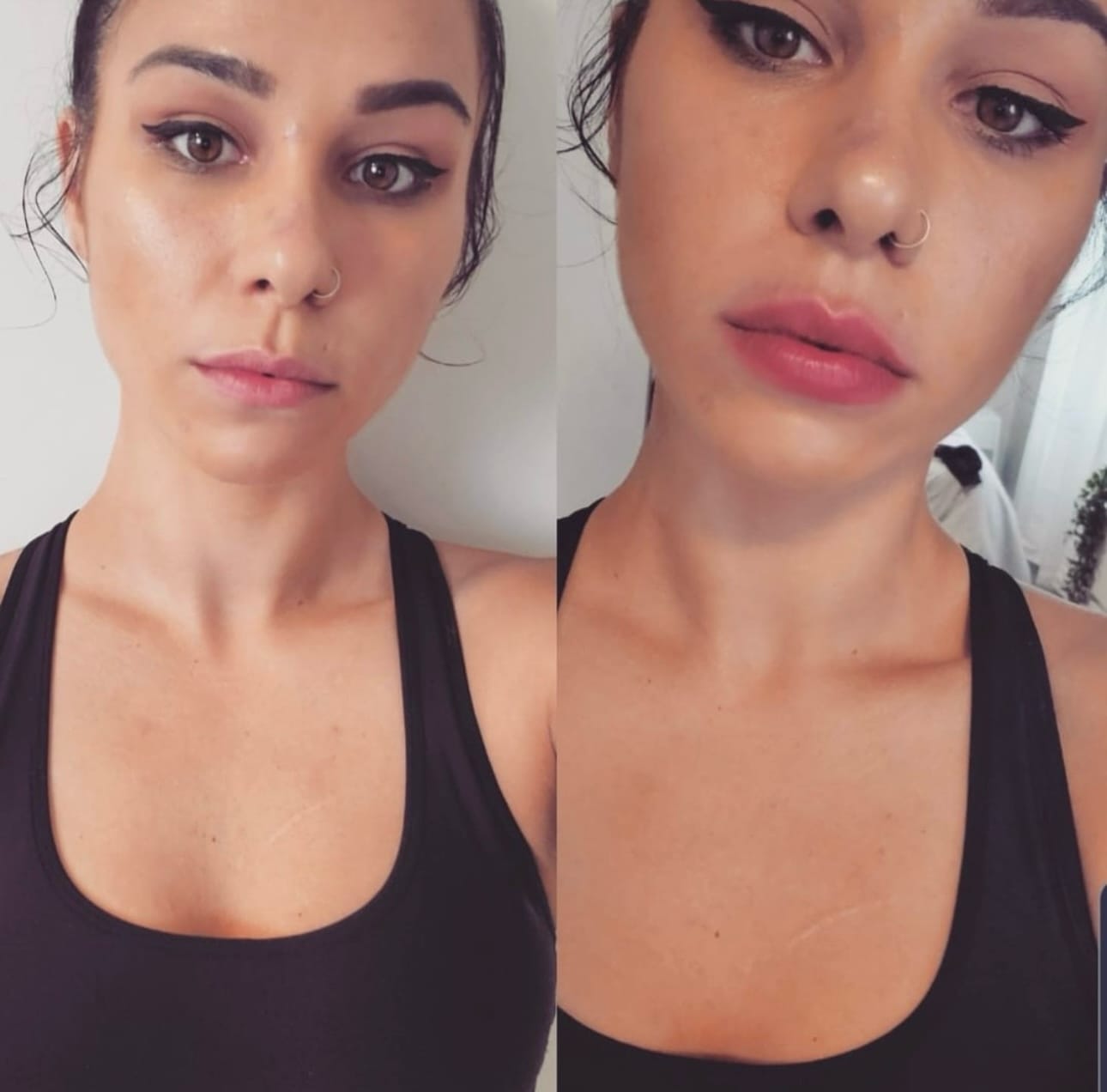 Customer photo review of Premium Lippen-Booster