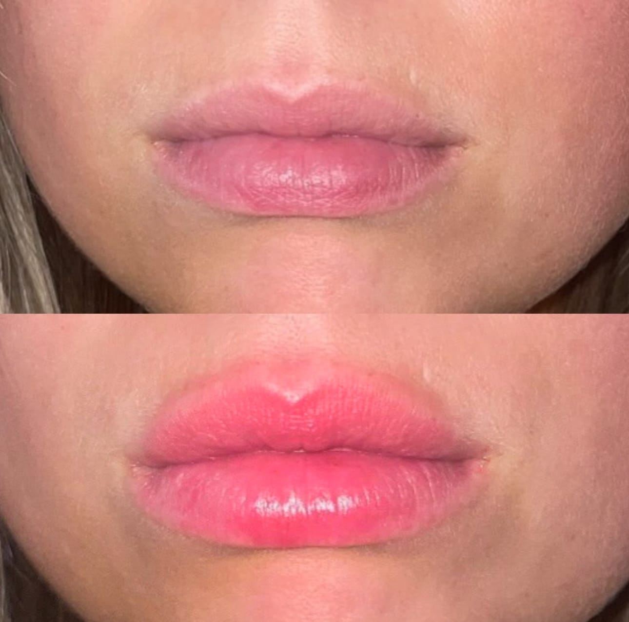 Customer photo review of Premium Lippen-Booster
