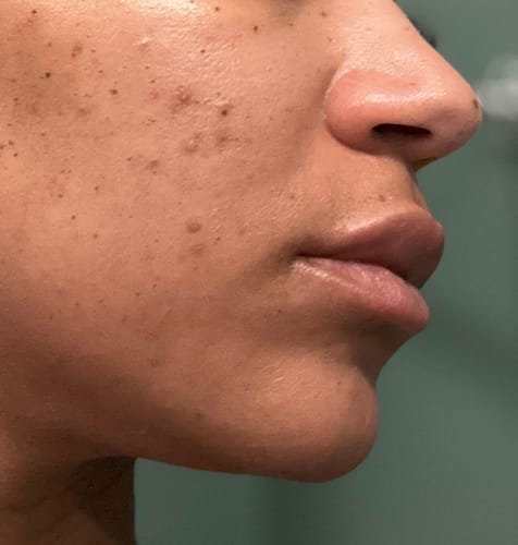 Customer photo review of Clearly Zinq® Hydrating Facial SPF 35 + Growth Factor Sunscreen Mineral Gel/Primer