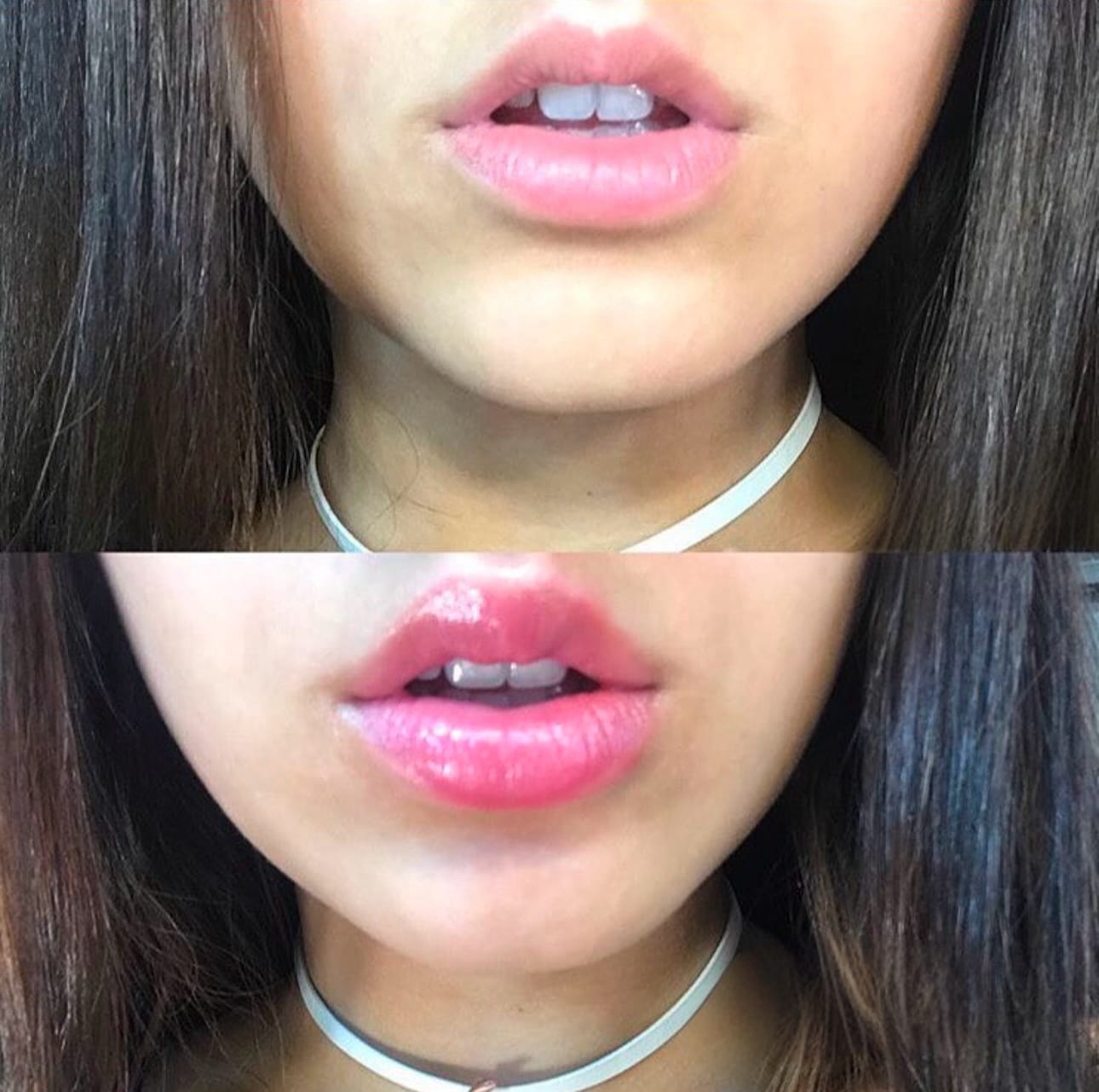 Customer photo review of Premium Lippen-Booster