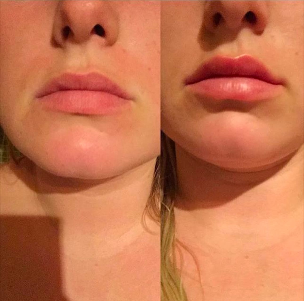 Customer photo review of Premium Lippen-Booster