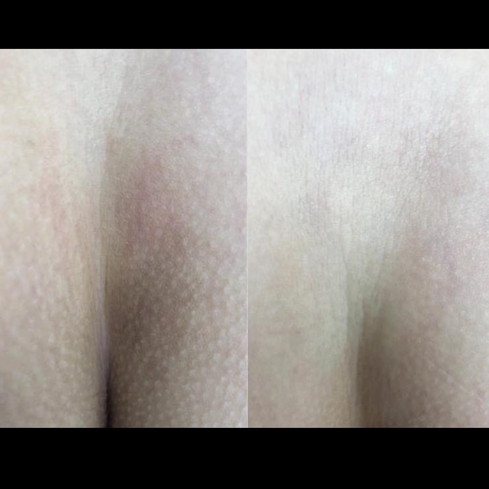 Customer photo review of Crema Aclarante Skinglow