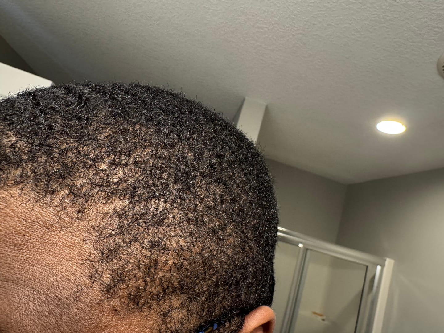 Customer photo review of Hair Oil & Hair Moisturizer Kit