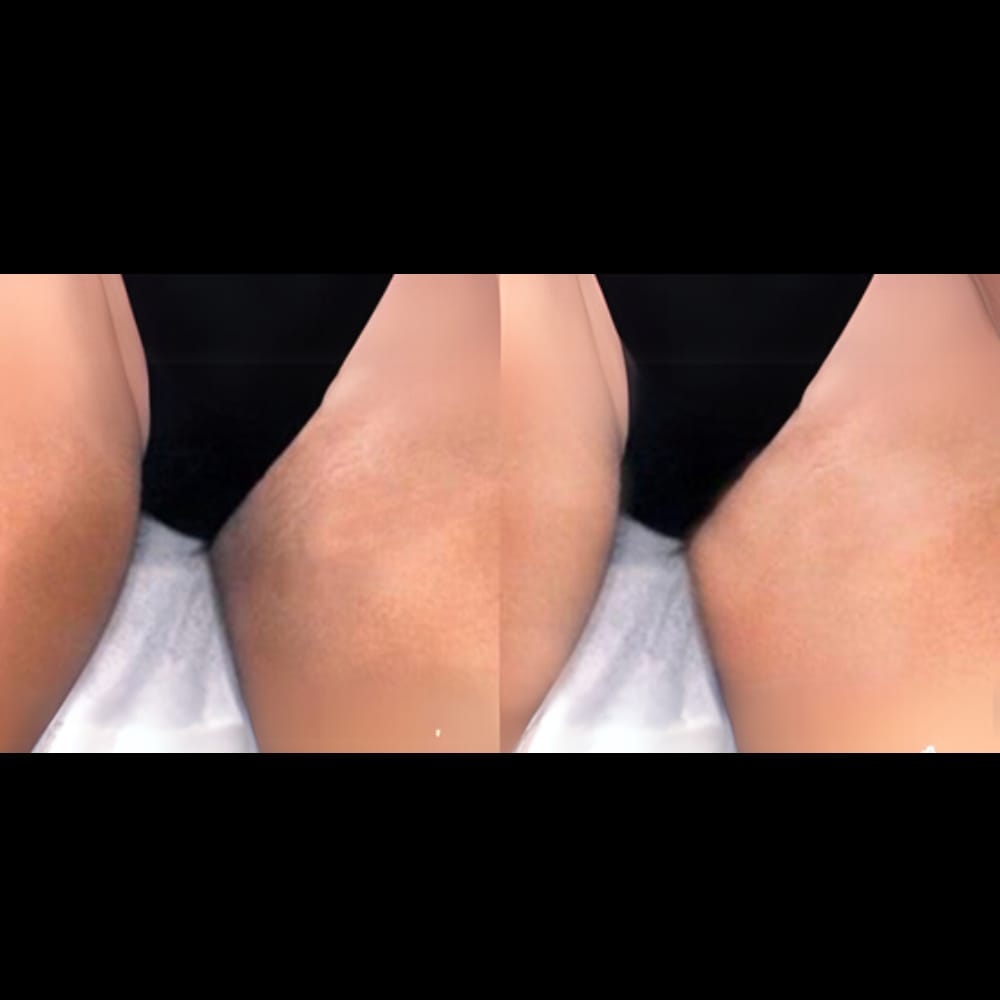 Customer photo review of Crema Aclarante Skinglow