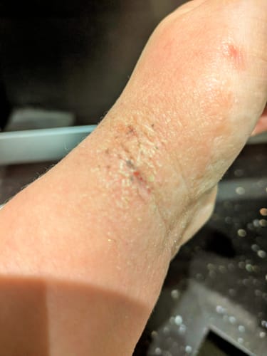 Customer photo review of Soothing Balm Duo