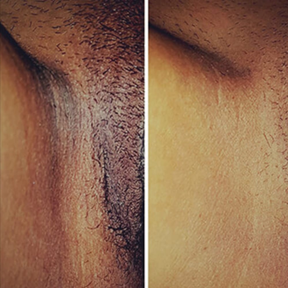 Customer photo review of Crema Aclarante Skinglow