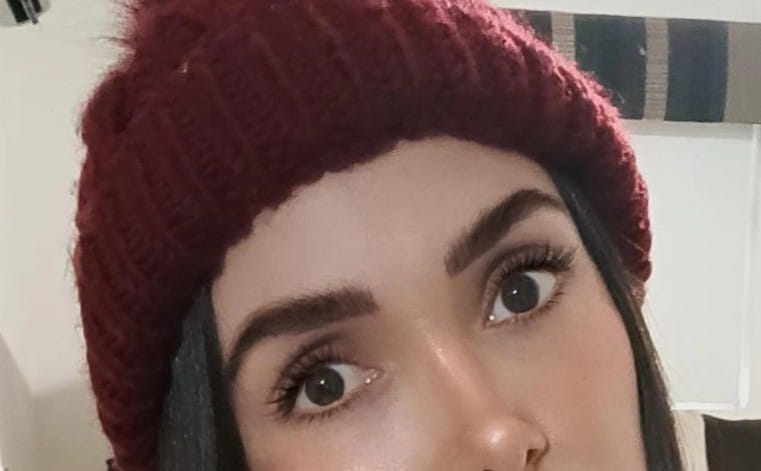 Customer photo review of CS EYELASH - Suero crecimiento de pestañas y cejas