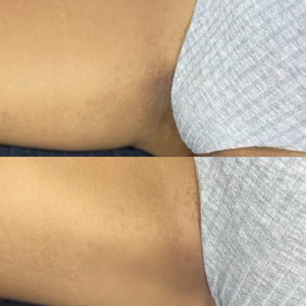 Customer photo review of Crema Aclarante Skinglow