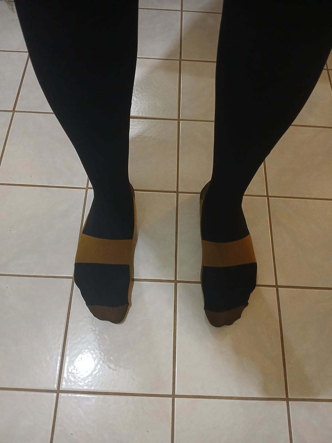 Customer photo review of Copper Compression Socks (3-Pack)
