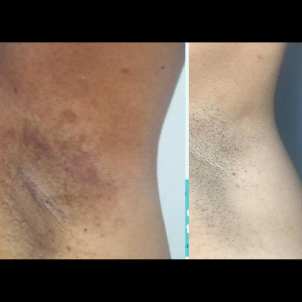 Customer photo review of Crema Aclarante Skinglow