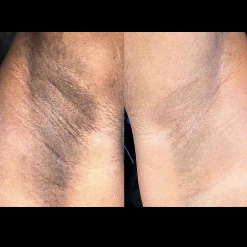 Customer photo review of Crema Aclarante Skinglow