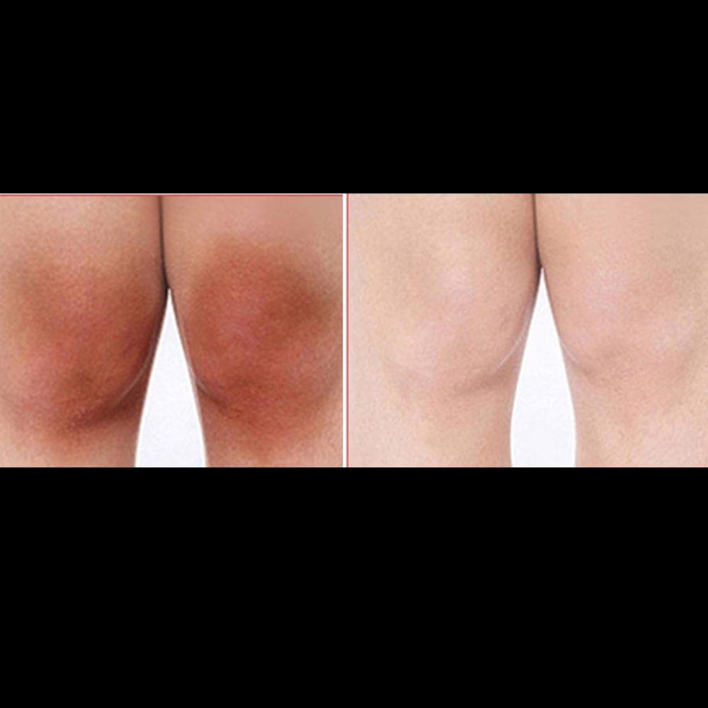 Customer photo review of Crema Aclarante Skinglow