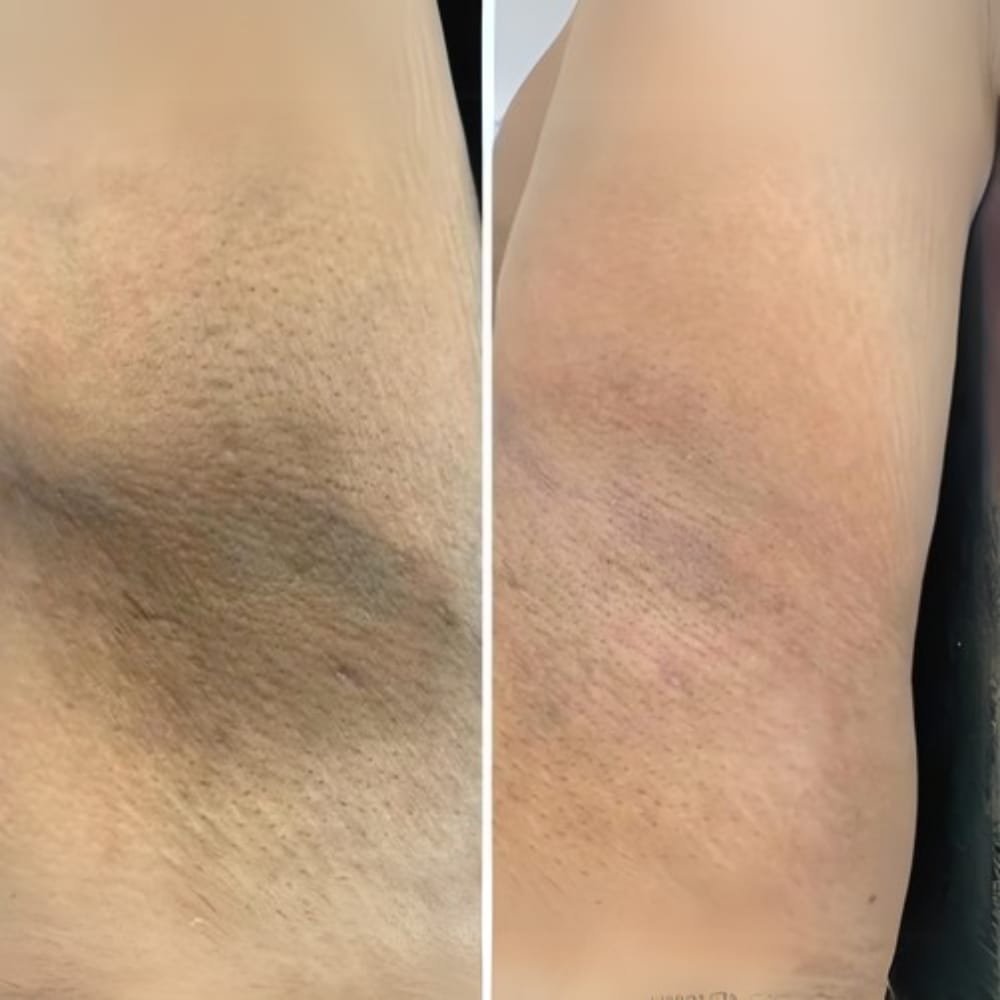 Customer photo review of Crema Aclarante Skinglow