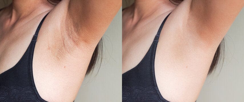 Customer photo review of Crema Aclarante Skinglow