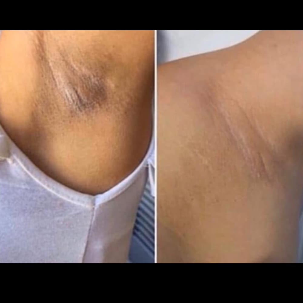 Customer photo review of Crema Aclarante Skinglow