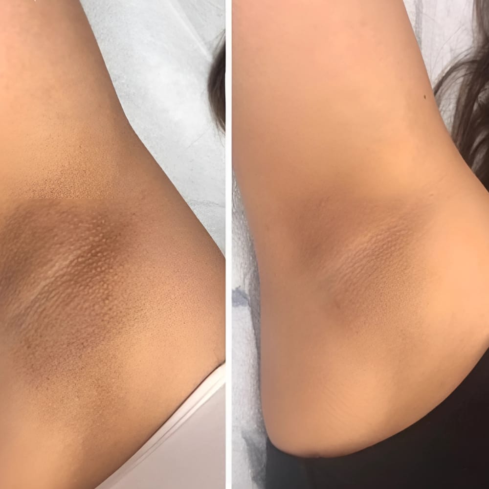 Customer photo review of Crema Aclarante Skinglow