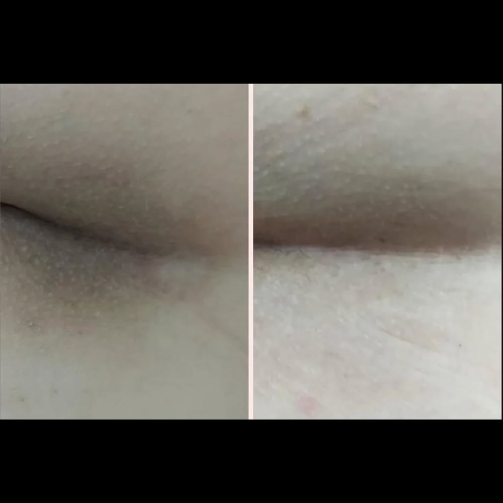 Customer photo review of Crema Aclarante Skinglow