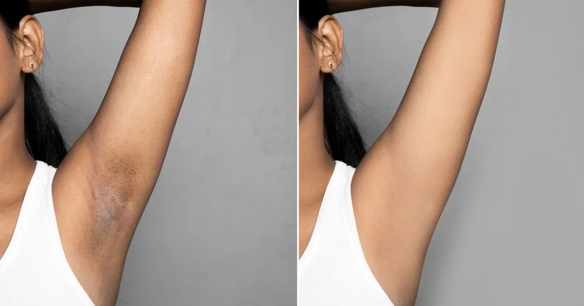 Customer photo review of Crema Aclarante Skinglow