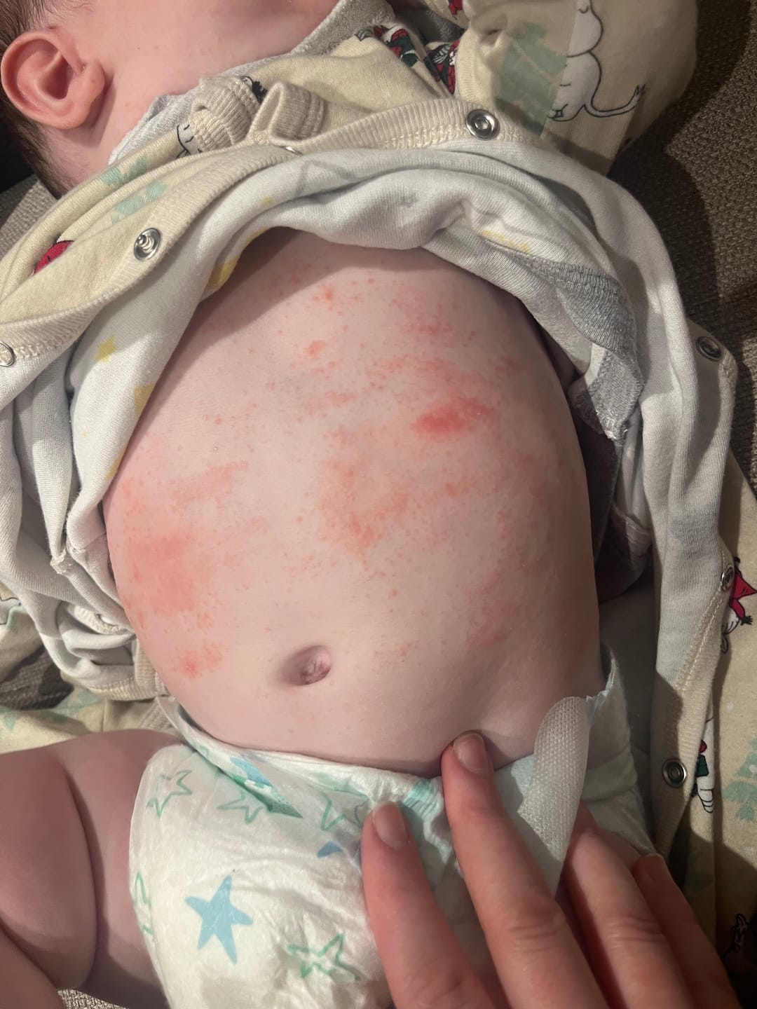 Customer photo review of Bioskin Junior Duo Pack