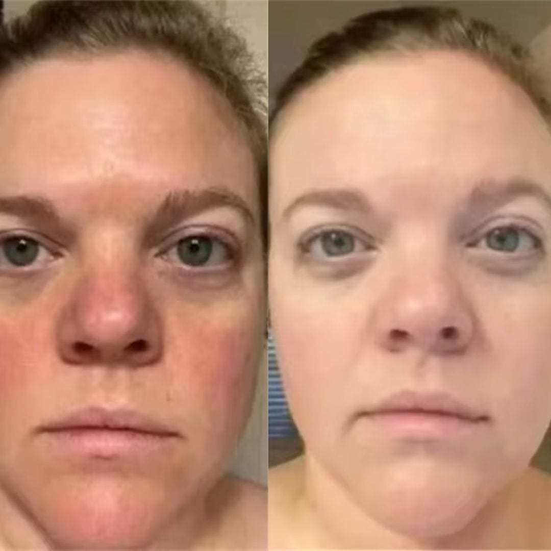 Customer photo review of The Naked Skin™ Collagen Overnight Wrapping Mask