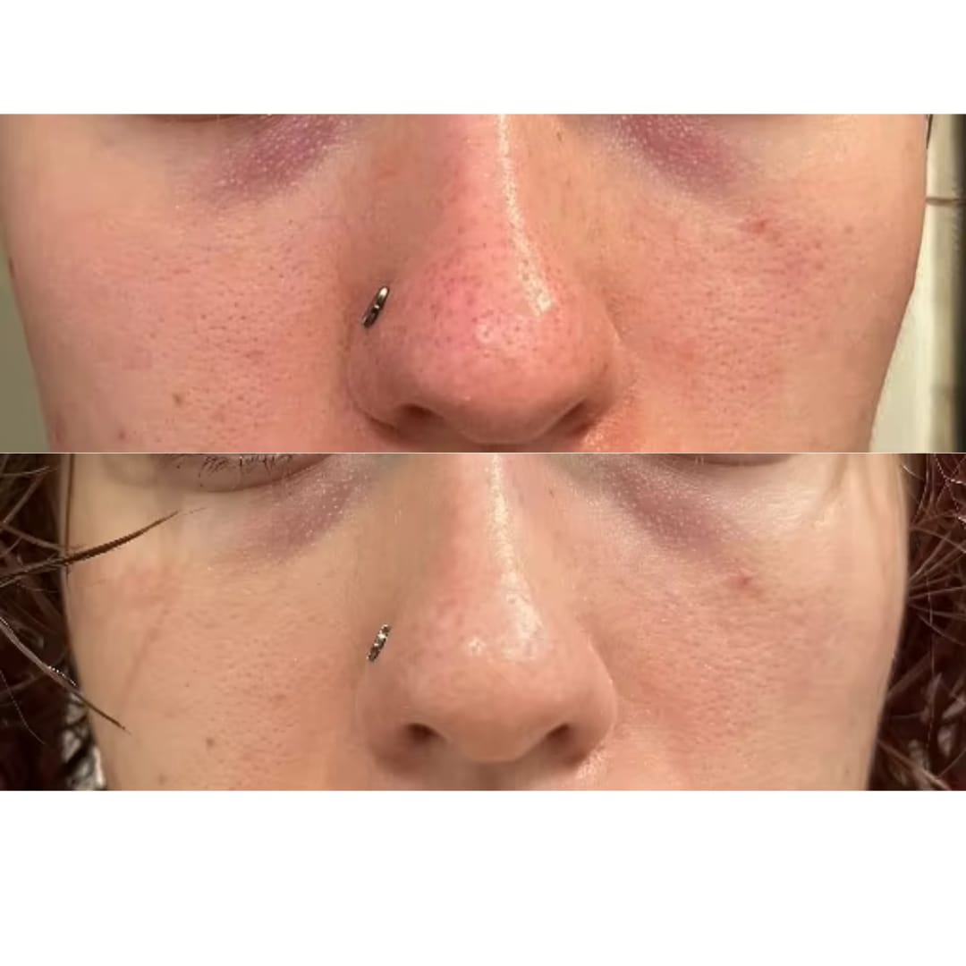Customer photo review of The Naked Skin™Collagen Jelly Cream