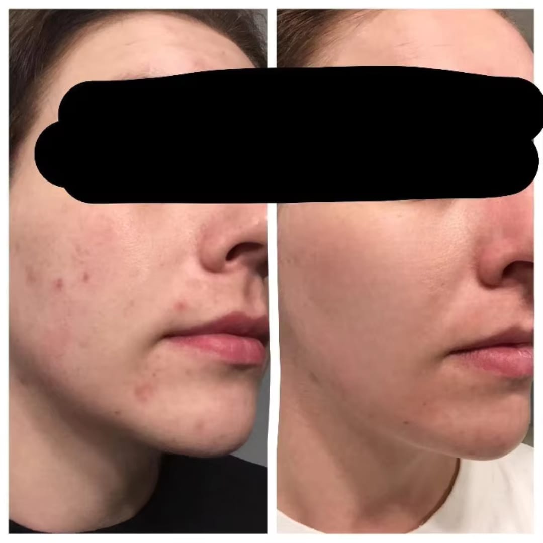 Customer photo review of The Naked Skin™Collagen Jelly Cream