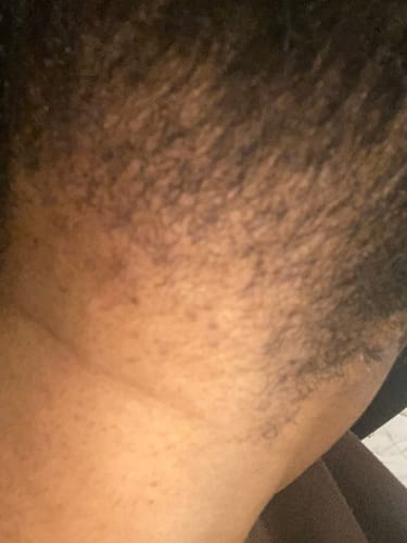 Customer photo review of Marine Collagen