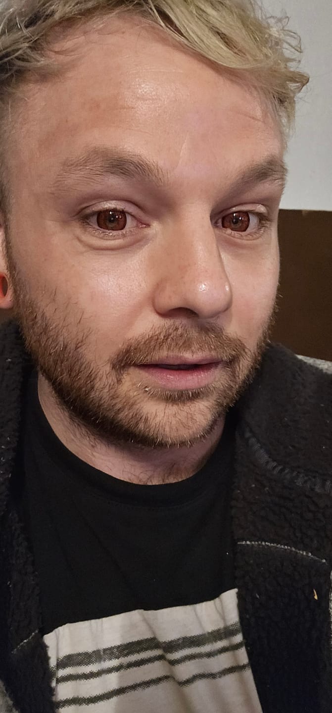 Customer photo review of Cosplay ICE Red Prescription Colored Contact Lenses