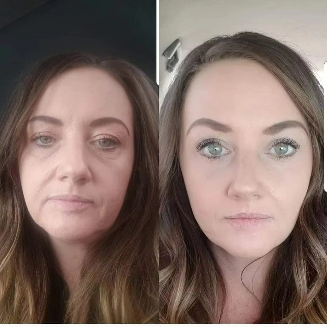 Customer photo review of The Naked Skin™Collagen Jelly Cream