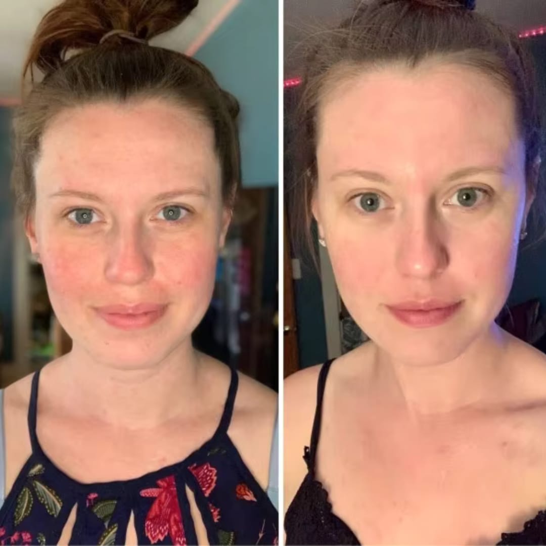 Customer photo review of The Naked Skin™Collagen Jelly Cream