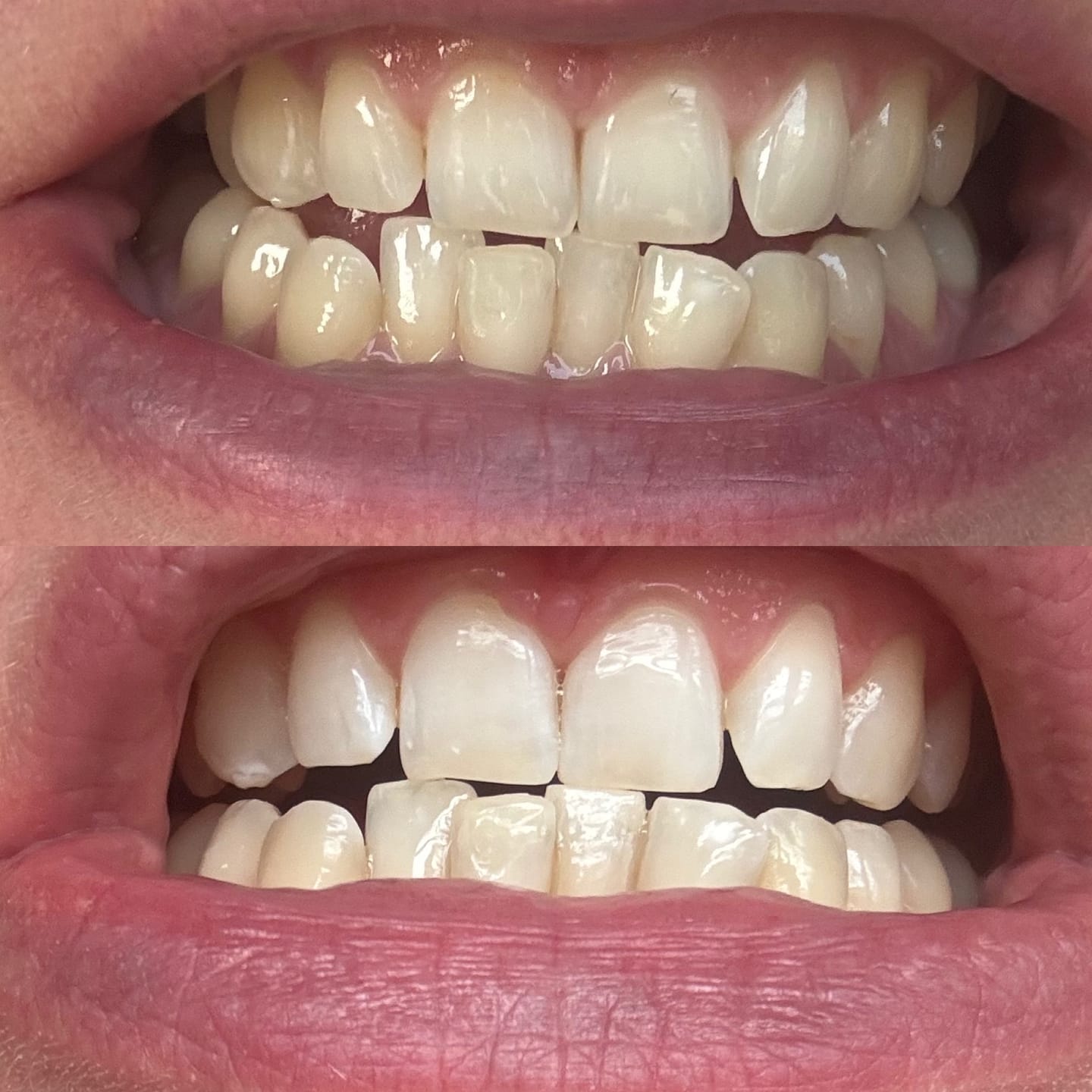 Customer photo review of Teeth Whitening Toothpaste Strawberry