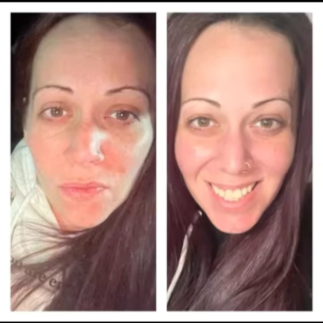 Customer photo review of The Naked Skin™Collagen Jelly Cream