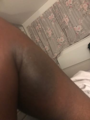 Customer photo review of Magix Cream